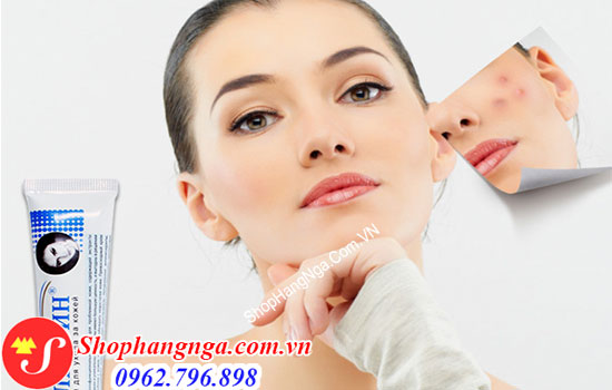 Kem trị sẹo Klirvin của Nga