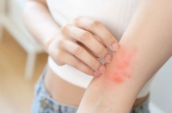 Tác dụng phụ của nấm Chaga là gì, ai không nên uống?